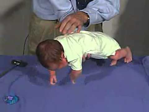 17/23. Clinical Pediatrics:  Normal MS Tone 2