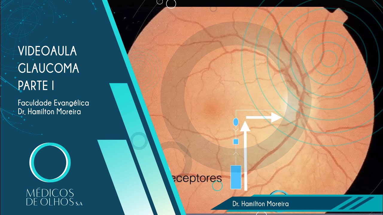 Videoaula Glaucoma - Conceitos Básicos e Conceitos Clínicos | PARTE I