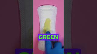 Why Is My Vaginal Discharge Yellow Or Green!  #womenshealth #patienteducation