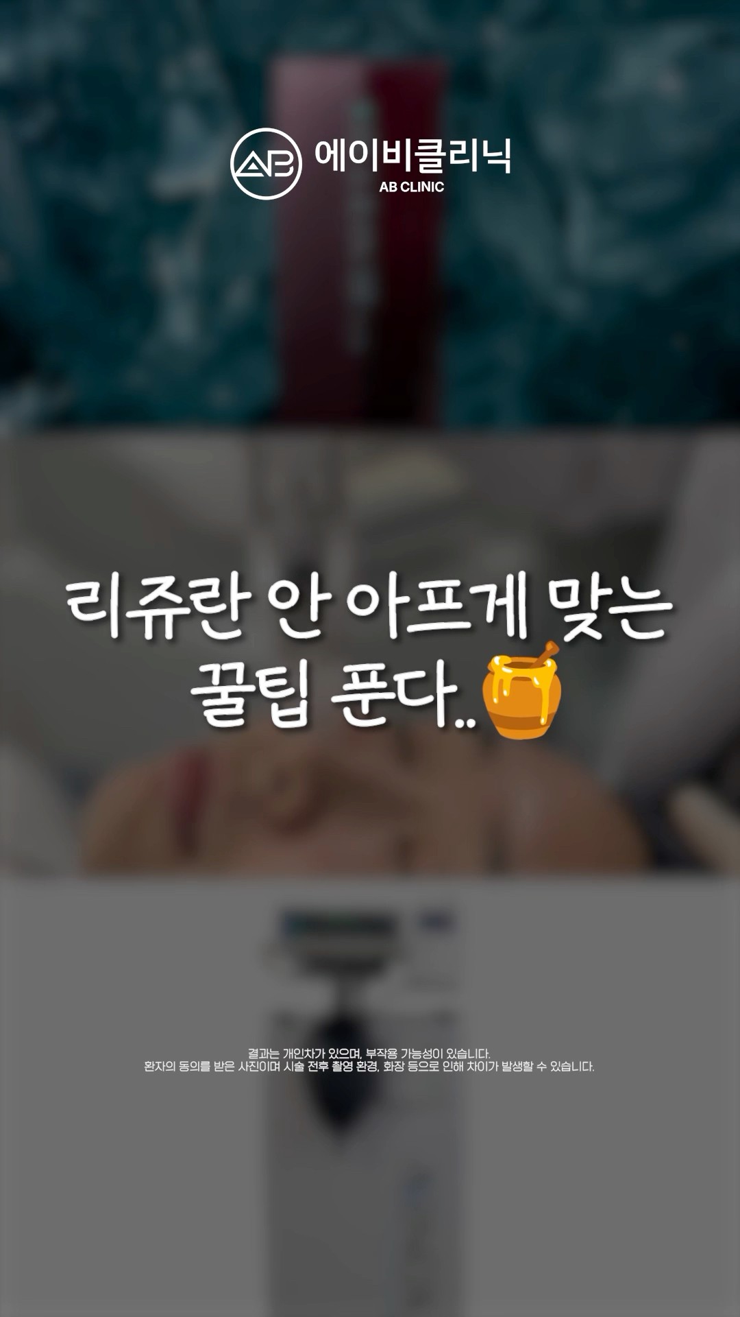 통증 땜에 미뤘던 리쥬란, 이렇게 해보세요❗