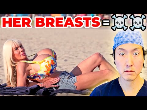 She Has the LARGEST BREASTS Ever!! EXTREME Bodies EXPLAINED!