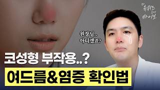 [Dr.유퀴즈온더바이브] 염증인지 여드름인지 모르겠다면? 피지관리, 코팩, 여드름 전부 답해드립니다!｜코수술 후 여드름 QnA 1탄