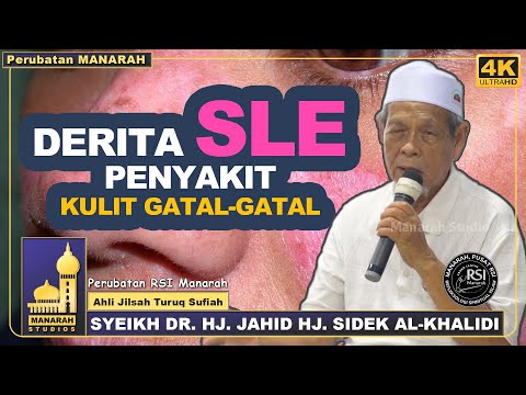 Derita Penyakit SLE Gatal-gatal Boleh Dirawat Di Manarah