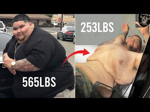 My 300lbs Weight Loss Left Me With 20lbs Of Loose Skin | BRAND NEW ME