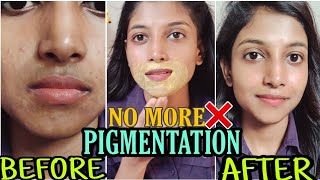 Remove HYPER PIGMENTATION around mouth 2020😍 Results in 5 Days