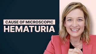 Determining The CAUSE OF MICROSCOPIC HEMATURIA