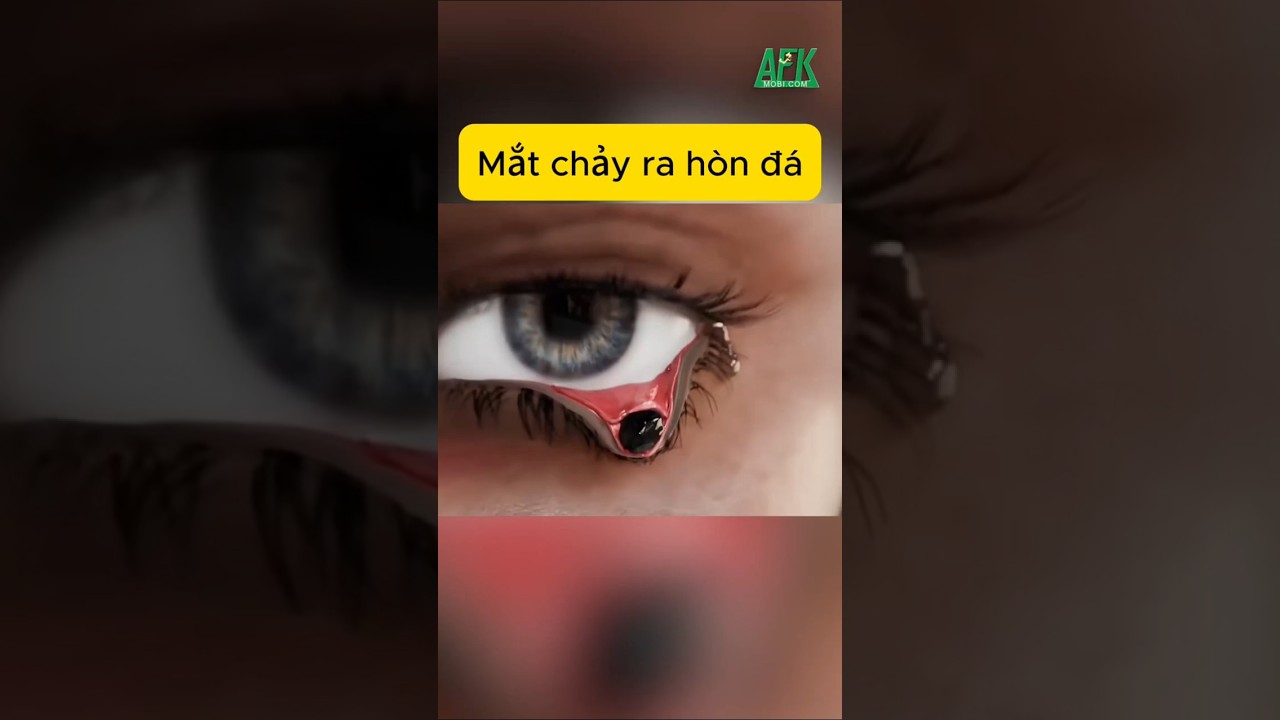 Mắt chảy ra hòn đá bí ẩn