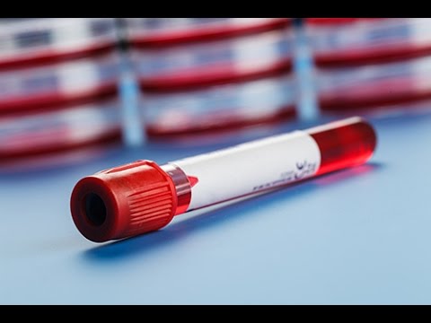 comment guerir hypothyroidie