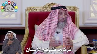 151 - تركيب تقويم الأسنان - عثمان الخميس