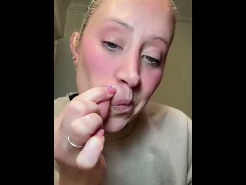 Гидроколлоидные патчи от прыщей и акне 200 шт BeeChip ACNE PATCH / Пластырь косметический для лечения акне - фото 1 - id-p2527355835