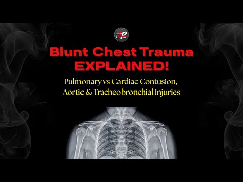 Blunt Chest Trauma Explained: Pulmonary vs Cardiac Contusion, Aortic & Tracheobronchial Injuries