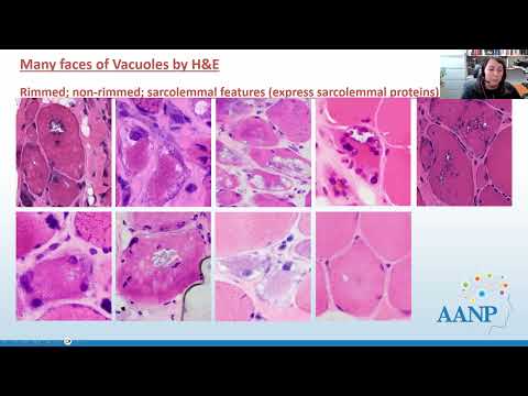 AANP Teaching Rounds - March 18, 2024 - Muscle Pathology Across a Spectrum