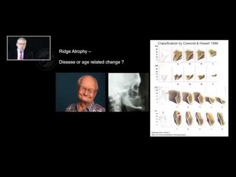 Major bone regeneration procedures