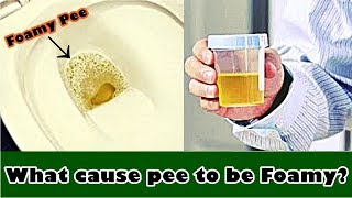 Frothy Urine – What cause pee to be Foamy?