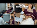 Dr Harish Grover Reveals Navel Displacement Cure