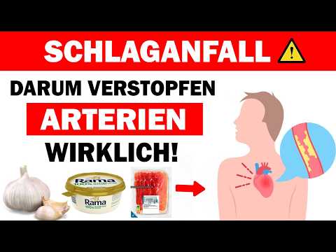 Diese Lebensmittel verstopfen Ihre Arterien und erhöhen das Schlaganfallrisiko. Meiden Sie sie