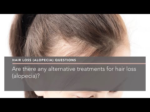 Are there any alternative treatments for hair loss (alopecia)?