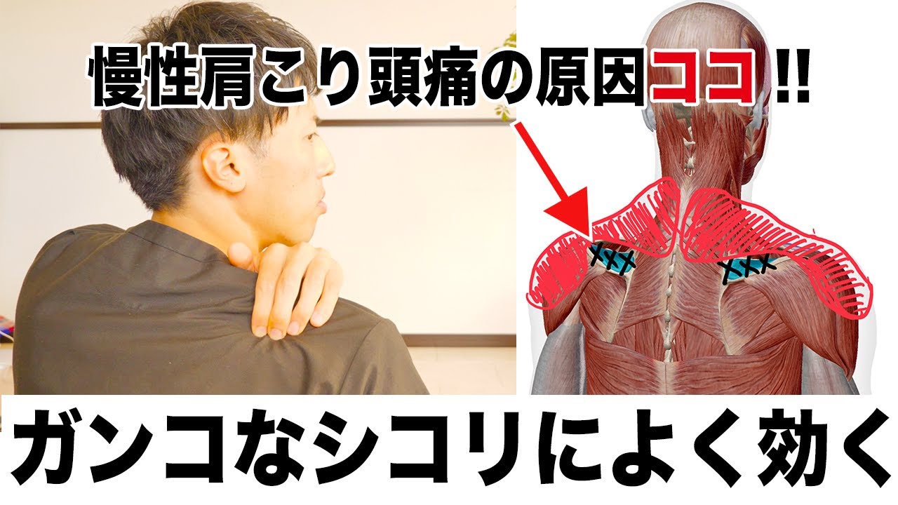 ガンコな肩こり頭痛を解消する深層筋マッサージ「棘上筋リリース」