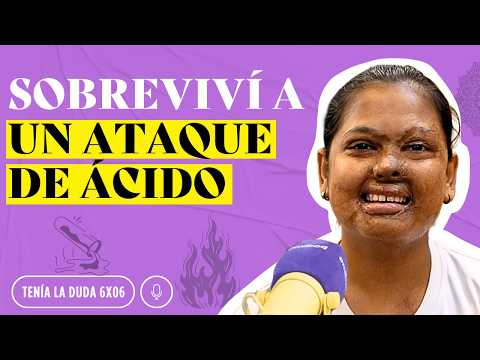 Así SOBREVIVÍ a un ATAQUE DE ÁCIDO: Mi historia