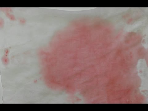 Rotweinflecken entfernen mit Backpulver & Essig -  Hausmittel Lifehack - Tutorial