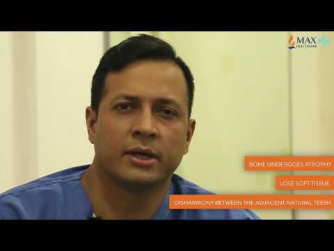 download lagu mp3 mp4 Tooth Implant Cost In Mumbai, download lagu Tooth Implant Cost In Mumbai gratis, unduh video klip Tooth Implant Cost In Mumbai