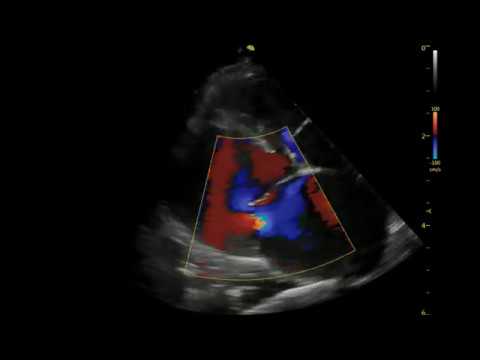 Case study: kardiomiopatia restrykcyjna u kota