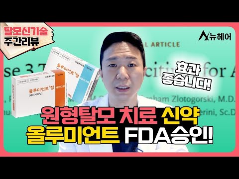 [#탈모신기술 주간리뷰] 원형탈모 치료 신약 올루미언트 FDA 승인소식!