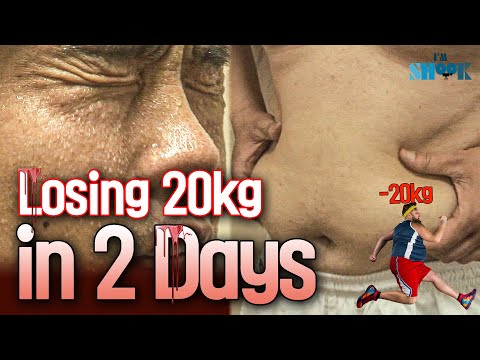 (Real Situation) 20kg Weight Loss Challenge in Two Days