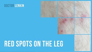 🦵🦵 Red spots on the leg
