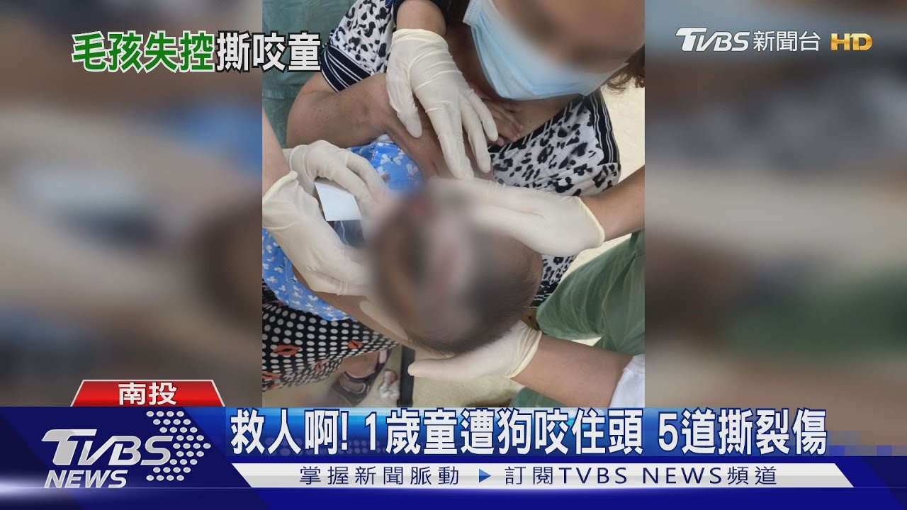 救人啊!1歲童遭狗咬住頭 5道撕裂傷