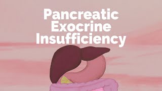 Pancreatic Exocrine Insufficiency | Gastrointestinal Society