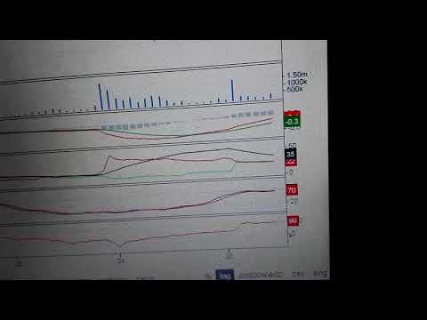 Analiza Biomed Lublin na  poniedzialek 3 stycznia 2021r