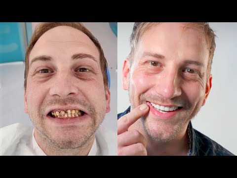 Dental treatment in Turkey | 10 questions