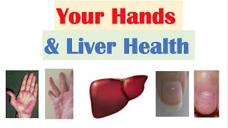 Your Hands & Liver Health | What Your Hands Can Tell You About Your Liver Health