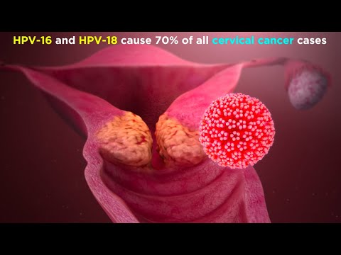 Human Papillomavirus (HPV)