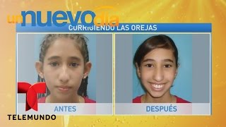 ¡Las orejas paradas sí tienen remedio! | Un Nuevo Día | Telemundo