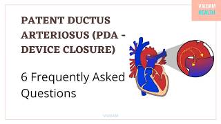 Patent ductus arteriosus-6 Frequently Asked Questions