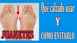 ❌️EVITA LA CIRUGÍA💉 JUANETES QUÉ ZAPATOS USAR/ CÒMO EVITAR O DISIMULAR/ TRUCOS Y CONSEJOS