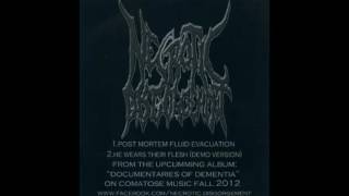 Necrotic Disgorgement - Demo 2012 [FULL]