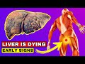 LIVER is DYING! 12 Weird Signs of LIVER DAMAGE