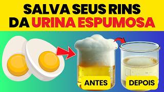 Os 6 Alimentos Estupendos que Protegem os Rins da Proteinúria | Manual do Corpo