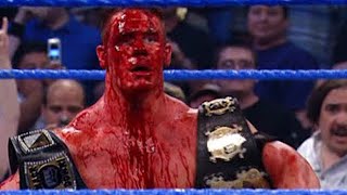 5 BLOODIEST WWE Matches Of All Time