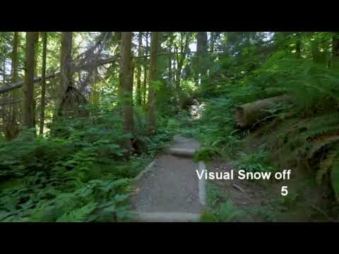 Visual Snow Illustrated