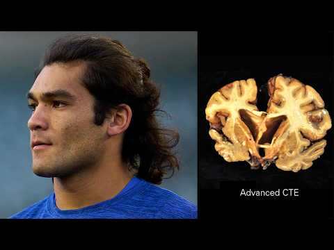 The Next Antonio Brown