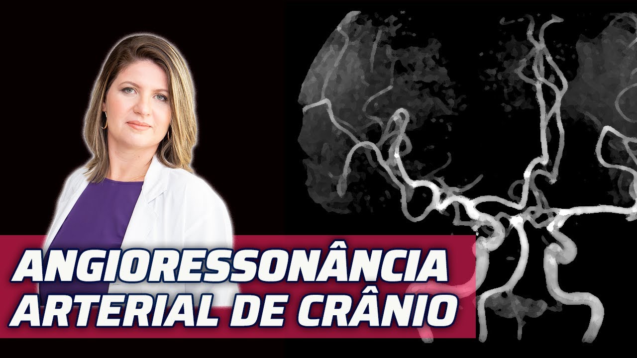 ANGIORESSONÂNCIA MAGNÉTICA ARTERIAL DE CRÂNIO: COMO AVALIAR ESSE EXAME?