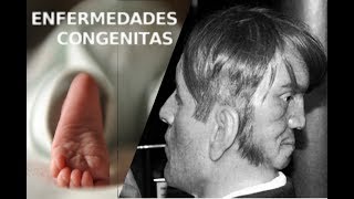 Enfermedades Congenitas | H3TV |