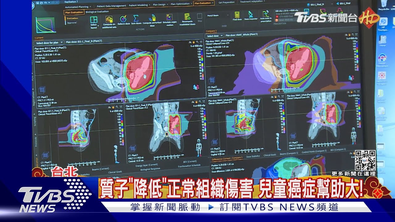 14醫院投入「質子、重粒子」抗癌 台密度冠全球