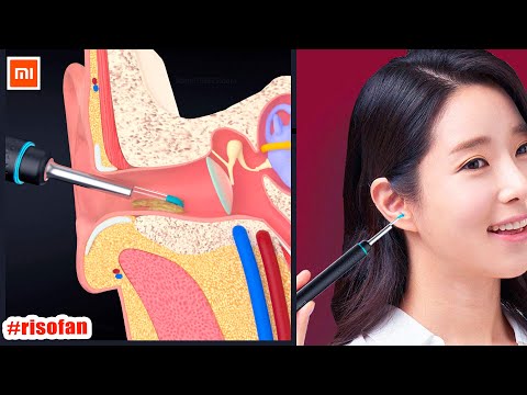 Xiaomi Bebird X17 Pro Smart Visual Ear Cleaning Rod.