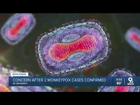 Monkeypox vaccine offered to high-risk residents in Hamilton County