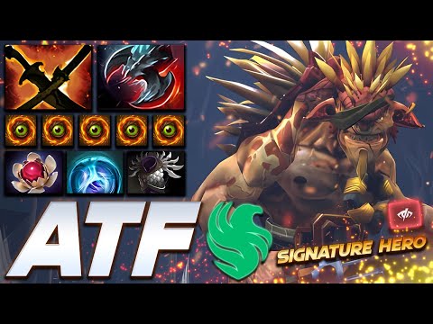 ATF Bristleback Signature Hero - Dota 2 Pro Gameplay [Watch & Learn]